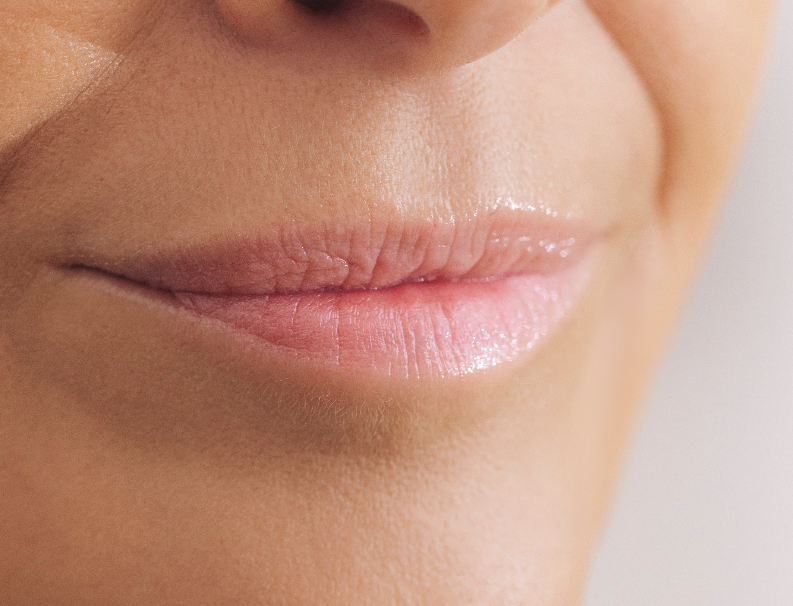 Lippenbehandlung - Moser Milani Lippenbehandlung - Moser Milani