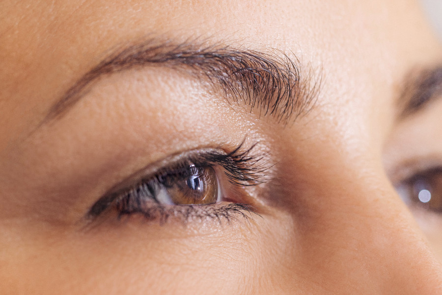 Dark circles and bags under the eyes – treatment at Moser Milani Medical Spa in Vienna
