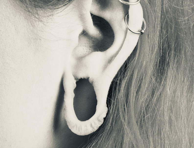 Earlobe correction