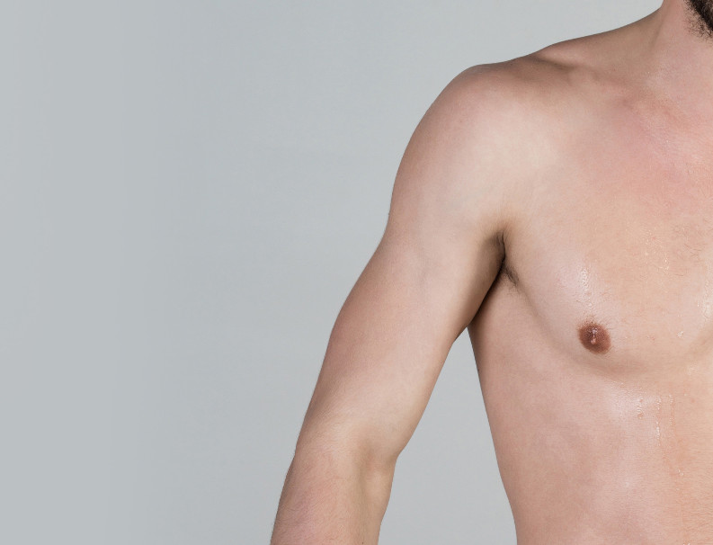 Treatment of gynecomastia