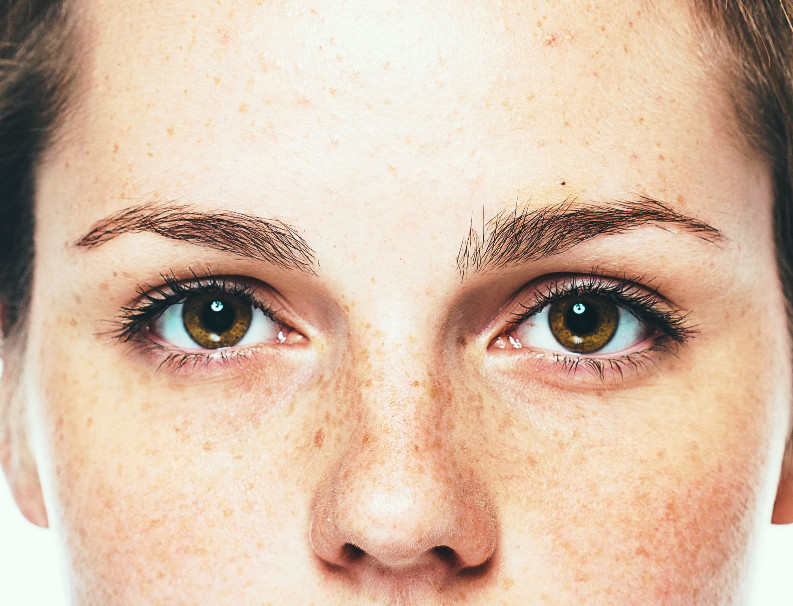 Clear your acne peeling