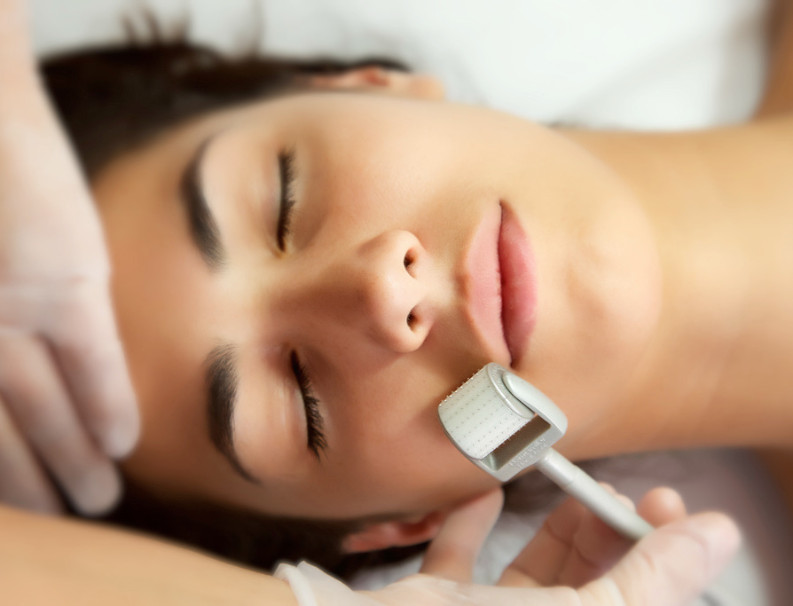Medical Needling/Skin Rejuvenation – Behandlung bei Moser Milani Medical Spa in Wien