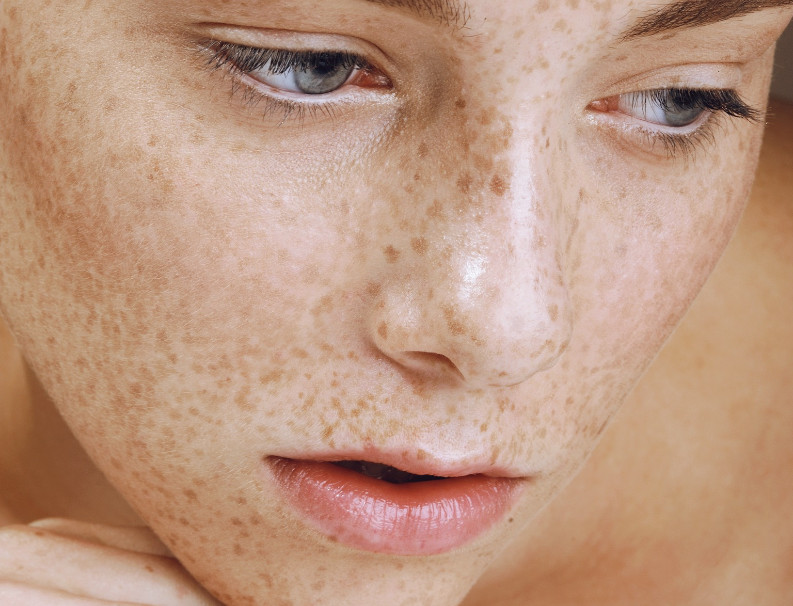 Initial consultation - skin analysis