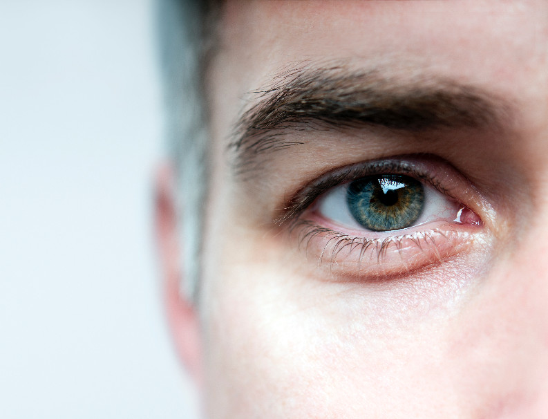 Müde Augen – Behandlung bei Moser Milani Medical Spa in Wien