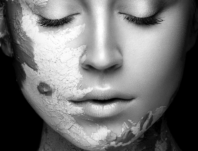Pale and sun-damaged skin – treatment at Moser Milani Medical Spa in Vienna