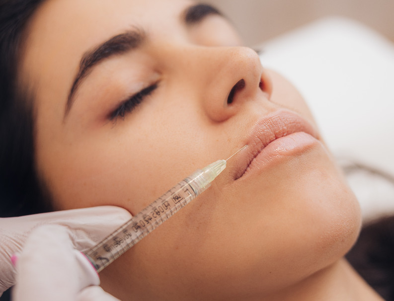 Lip treatment – treatment at Moser Milani Medical Spa in Vienna