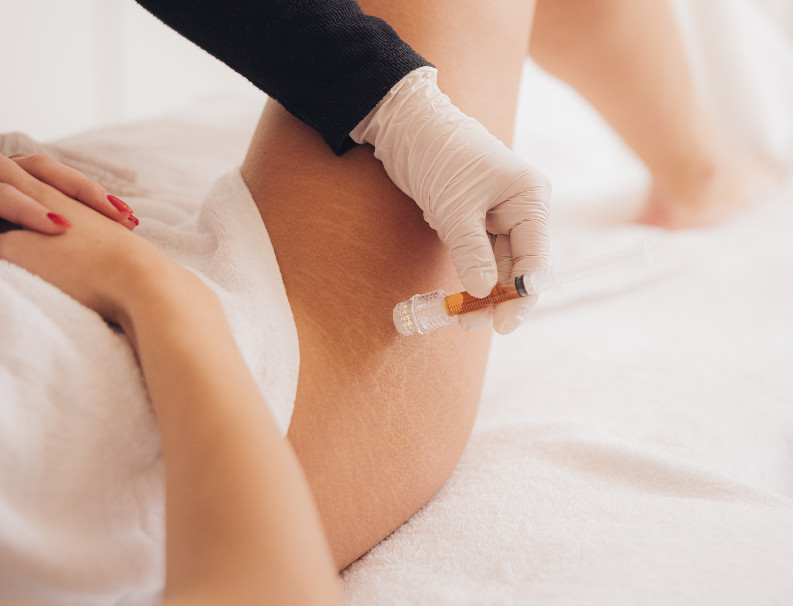 Microinfusion therapy – treatment at Moser Milani Medical Spa in Vienna