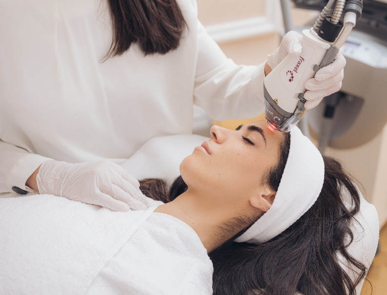 Laser for skin improvement – treatment at Moser Milani Medical Spa in Vienna