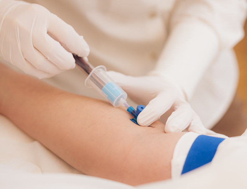 Laboruntersuchung inkl. Befundbesprechung – Behandlung bei Moser Milani Medical Spa in Wien