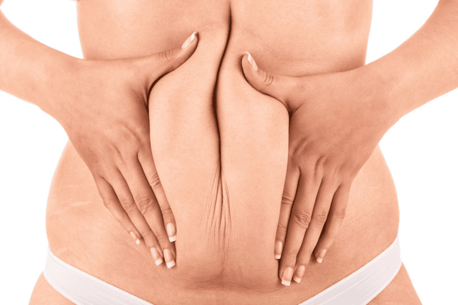 Shape Your Desired Body with Vaser Liposuction: A Comprehensive Guide